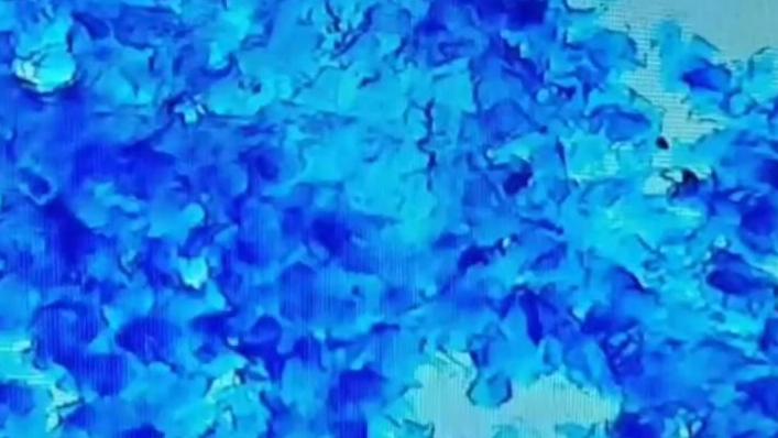 Cornified cells on the microscope screen during a dog cytology reading